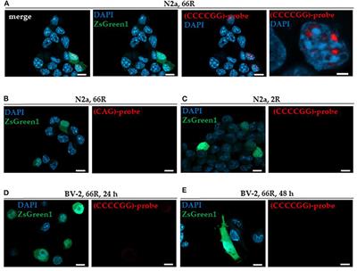BV-2 Microglial Cells Overexpressing C9orf72 Hexanucleotide Repeat Expansion Produce DPR Proteins and Show Normal Functionality but No RNA Foci